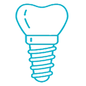 Implantes dentales